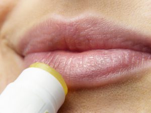 oorzaak droge lippen