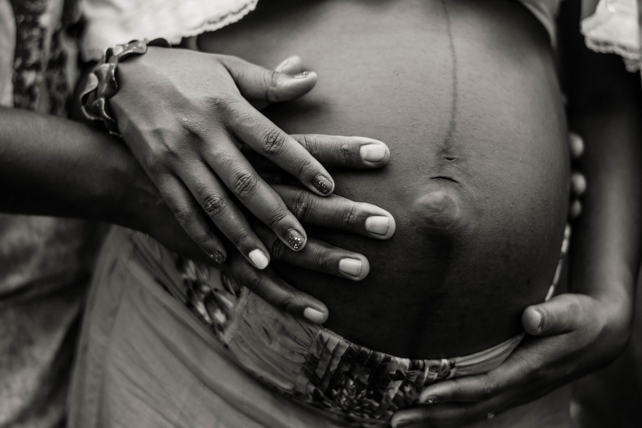 Buik van een zwangere vrouw met linea nigra, een lichamelijke verandering die ook na de bevalling kan blijven