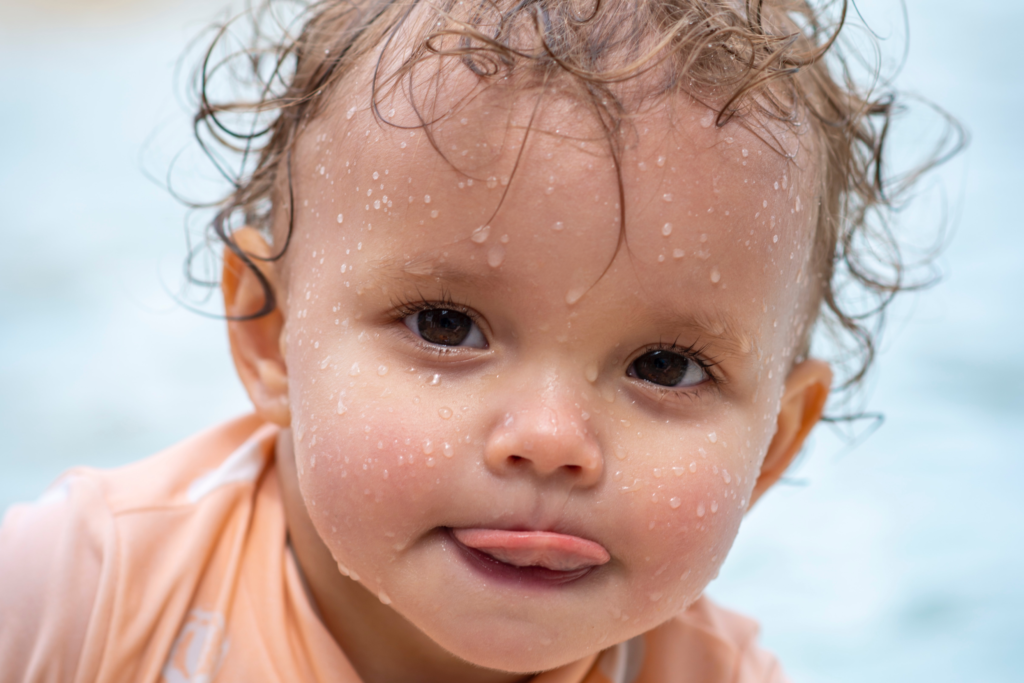 Het knippen van de tongriem bij baby's een booming business