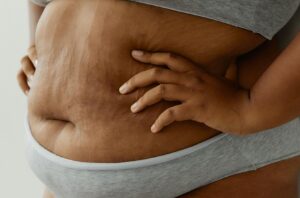 overgewicht en de kans op een zwangerschap